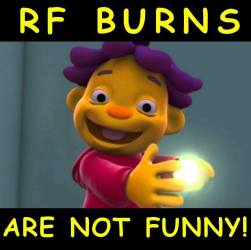 RF burn3.jpg